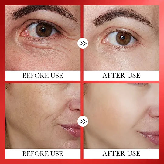 Skin Rejuvenation Serum