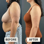 ComfortShape™ — Comfort en ondersteuning die met je meebeweegt.