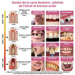 Biomimetische Tandherstelende Gel