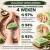 DermaShield – Vernietigt huidinfecties direct bij de bron. 1+1 Gratis!