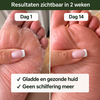 DermaShield – Vernietigt huidinfecties direct bij de bron. 1+1 Gratis!
