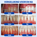 Evolyon GumRevive™ — Voor sterker en gezonder tandvlees.