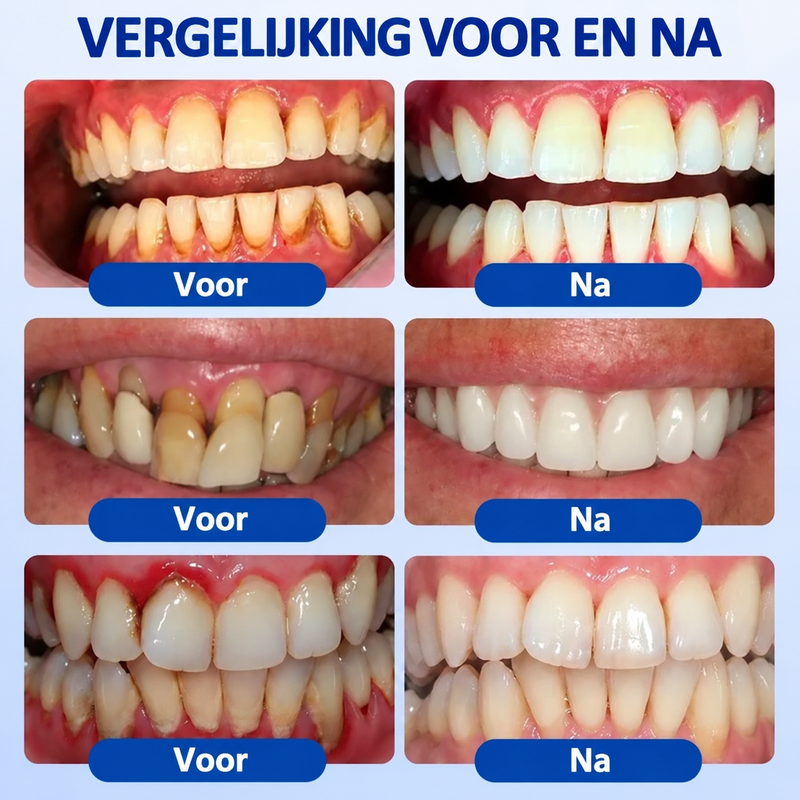 Evolyon GumRevive™ — Voor sterker en gezonder tandvlees.